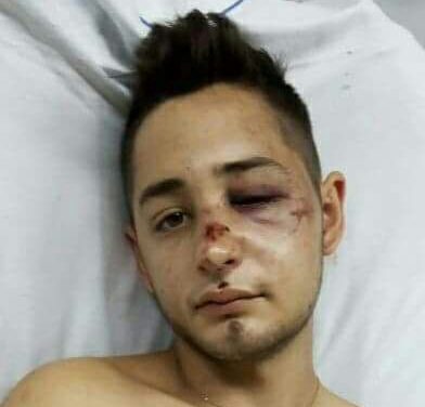PATOVICAS GOLPEAN A UN JOVEN A LA SALIDA DE UN BOLICHE EN LONGCHAMP