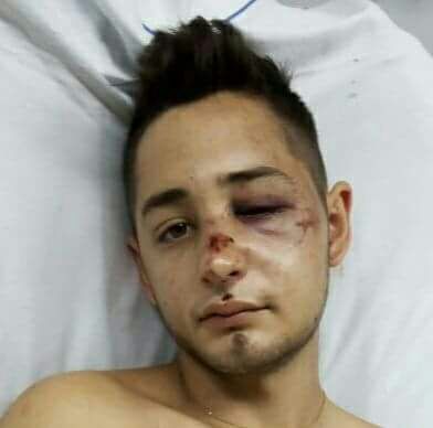 PATOVICAS GOLPEAN A UN JOVEN A LA SALIDA DE UN BOLICHE EN LONGCHAMP